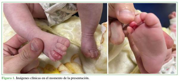 Bañador infantil: ¿Qué es síndrome de torniquete? - CSC