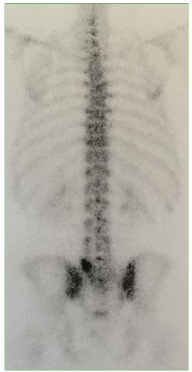 Faja Lumbar L2L3