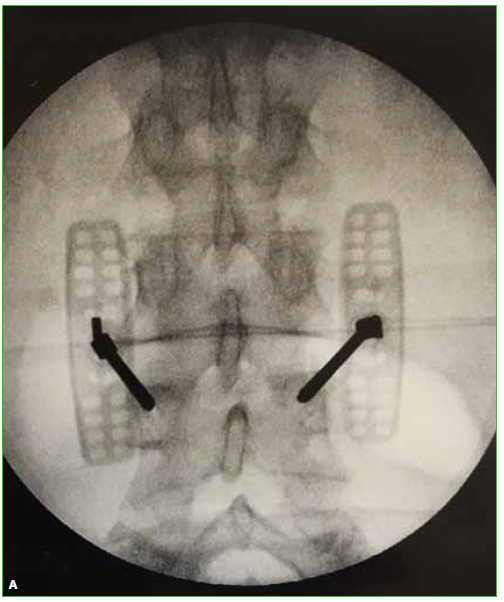 Faja Lumbar L2L3