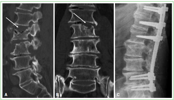 Patología de la columna vertebral  Hospital Universitario 12 de Octubre