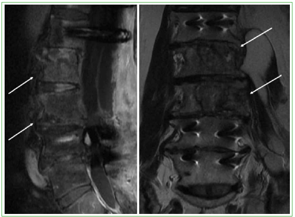 Patología de la columna vertebral  Hospital Universitario 12 de Octubre