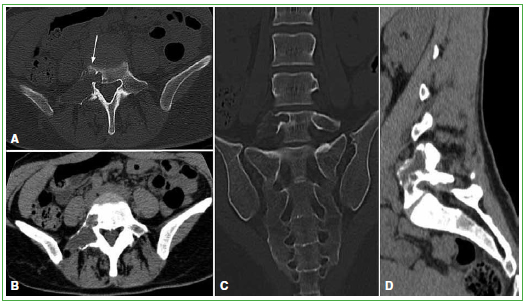 Columna vertebral radiografía estándar : anatomía normal