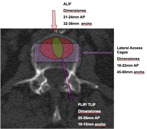 Columna lumbar [Neurocirugía Contemporánea ISSN 1988-2661]